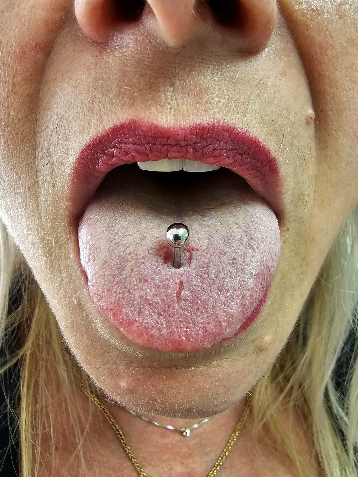 Tongue piercing